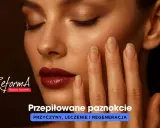 Kobieta z przepiłowanymi bokami paznokcia, ukazująca problem i potrzebę regeneracji.