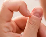 Dłoń z widocznymi, mocno obgryzione paznokcie i skórki wokół nich.