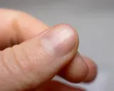 Zbliżenie na palec, ukazujące budowę paznokcia z widocznymi liniami wzrostu i półksiężycem.