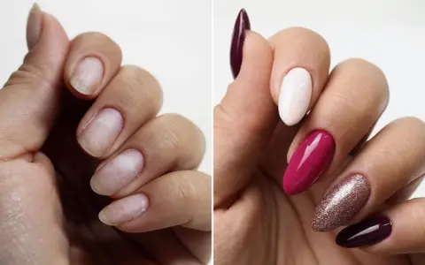 Przed i po: naturalne paznokcie vs. manicure z bazą do przedłużania paznokci, w kolorach śliwkowym, białym, malinowym i brokatowym.