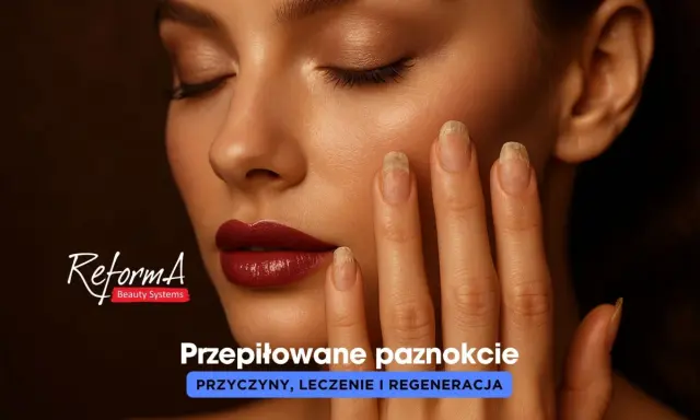 Kobieta z przepiłowanymi bokami paznokcia, ukazująca problem i potrzebę regeneracji.